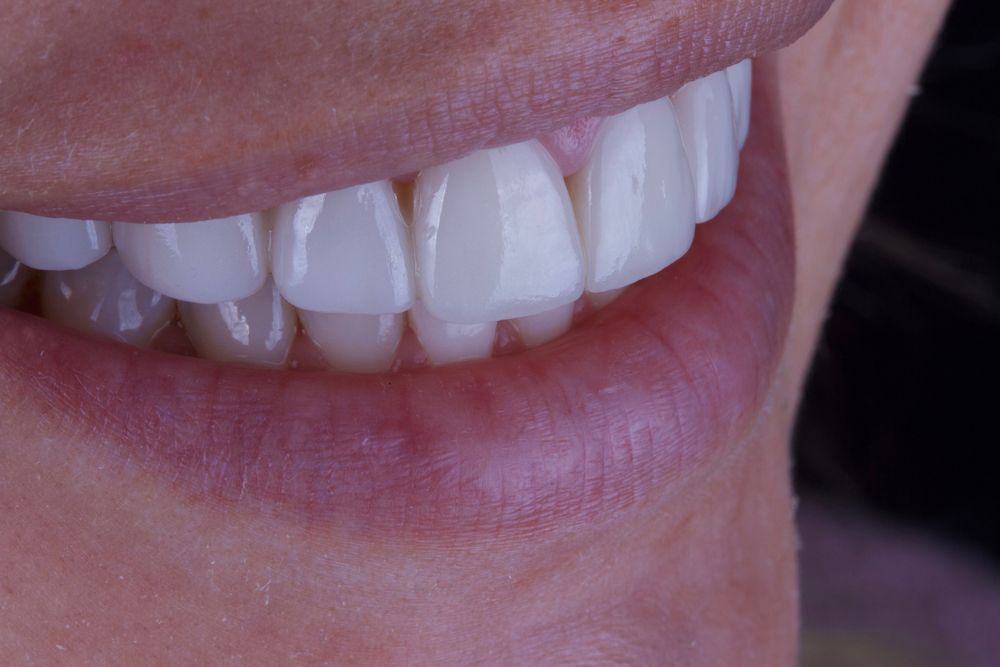 bright smile