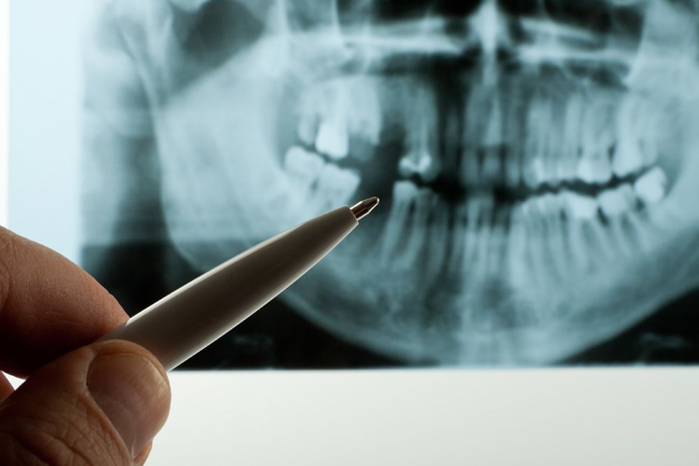 x-ray