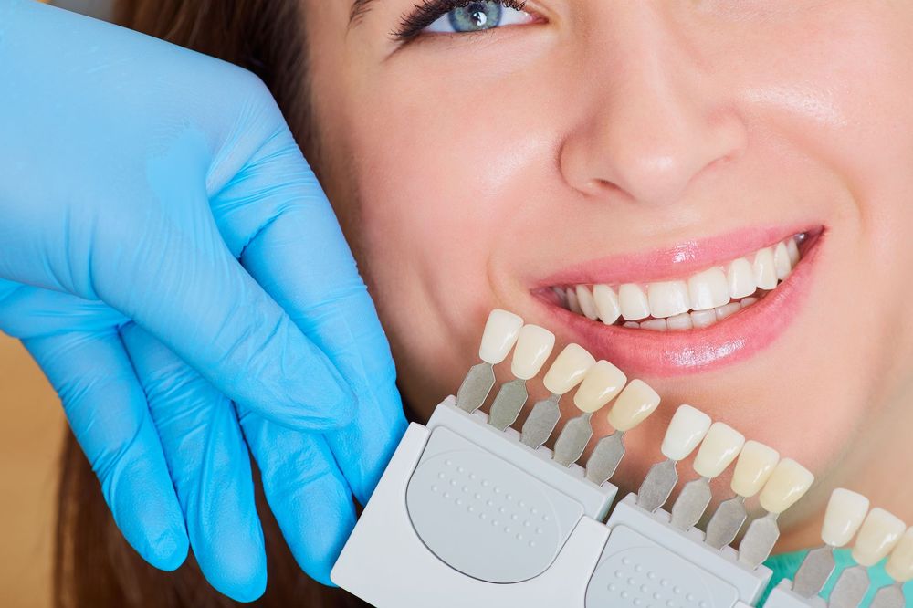tooth color guide