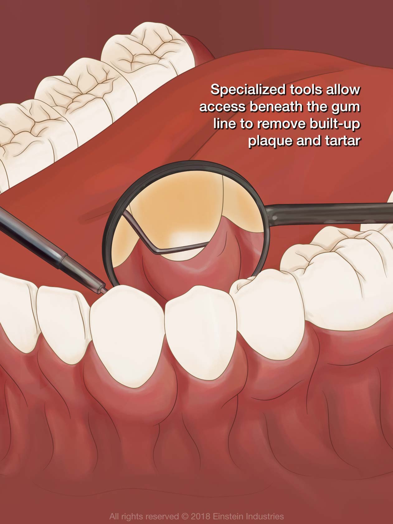 Illustration of dental mirror and teeth